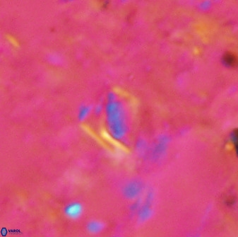 Calciosolenia aperta 49512
