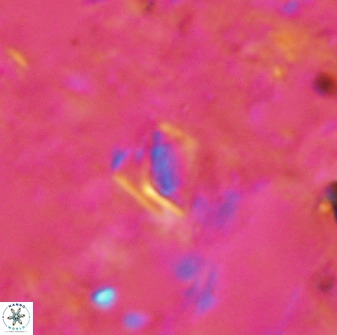 Calciosolenia aperta 49512