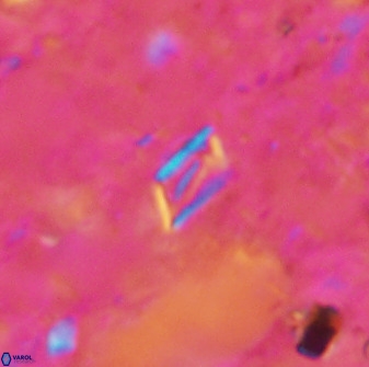 Calciosolenia aperta 49515