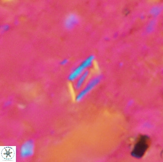 Calciosolenia aperta 49515