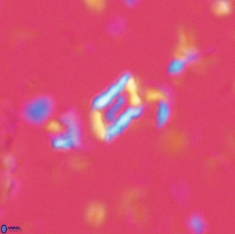 Calciosolenia aperta 59867