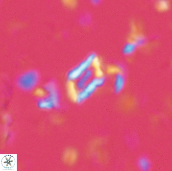 Calciosolenia aperta 59867