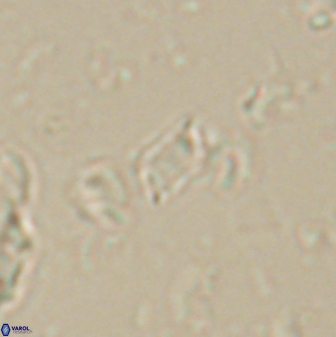 Calciosolenia aperta 59869