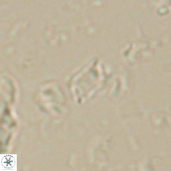Calciosolenia aperta 59869