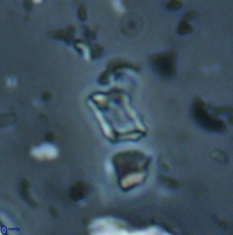 Calciosolenia aperta 59873