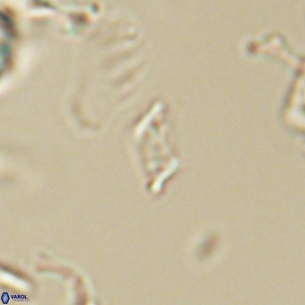 Calciosolenia aperta 69491