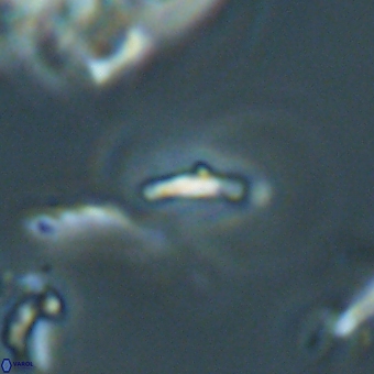 Calciosolenia aperta 69497