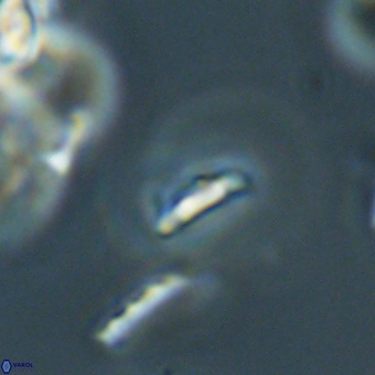 Calciosolenia aperta 69498
