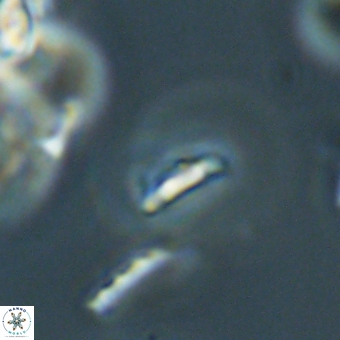 Calciosolenia aperta 69498