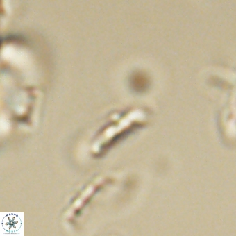 Calciosolenia aperta 69502