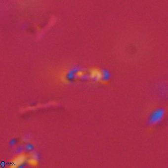 Calciosolenia aperta 69508