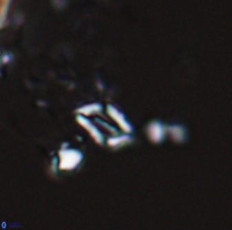 Calciosolenia aperta 25911
