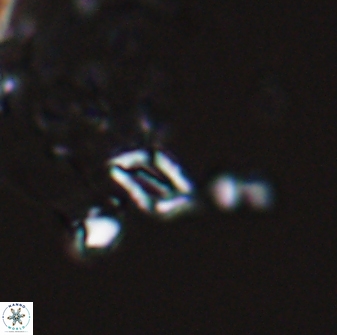 Calciosolenia aperta 25911