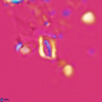 Calciosolenia aperta 25913