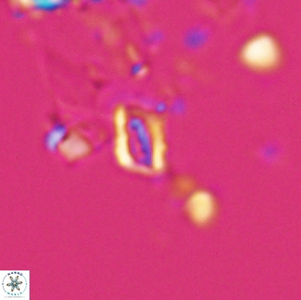 Calciosolenia aperta 25913
