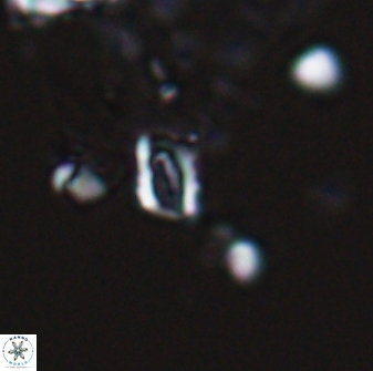 Calciosolenia aperta 25914