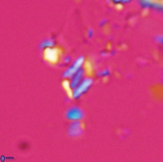 Calciosolenia aperta 25915