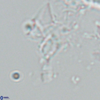 Calciosolenia aperta 25917