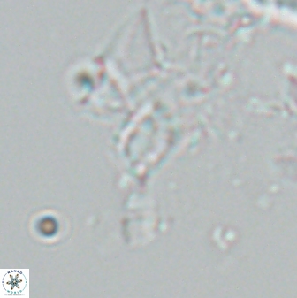 Calciosolenia aperta 25917