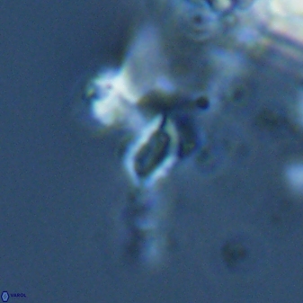 Calciosolenia aperta 25918