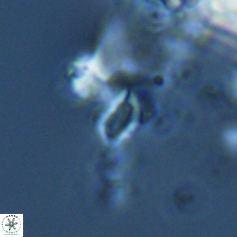 Calciosolenia aperta 25918