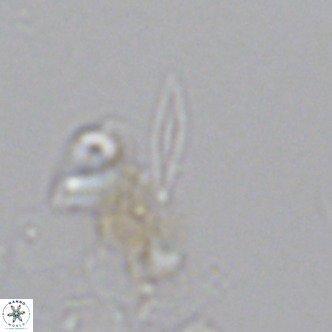 Calciosolenia fossilis VR 04078