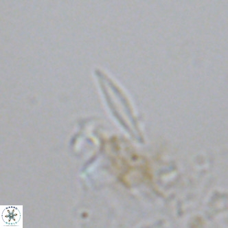 Calciosolenia fossilis VR 04079