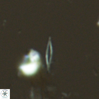 Calciosolenia fossilis VR 04071