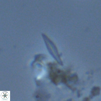 Calciosolenia fossilis VR 04081