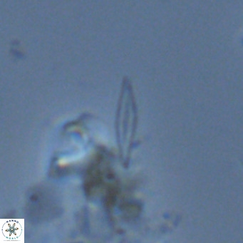 Calciosolenia fossilis VR 04082