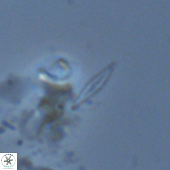 Calciosolenia fossilis VR 04083