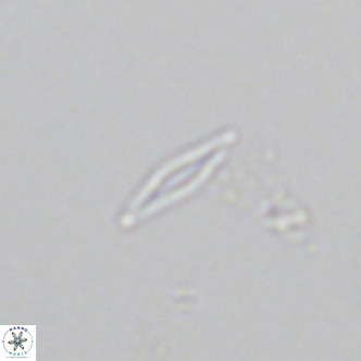 Calciosolenia fossilis VR 04988