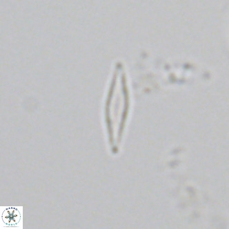Calciosolenia fossilis VR 04989