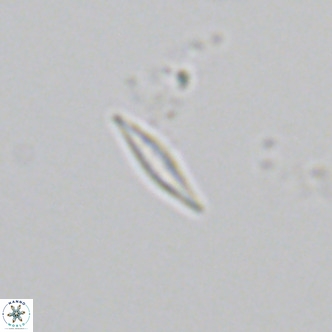 Calciosolenia fossilis VR 04990