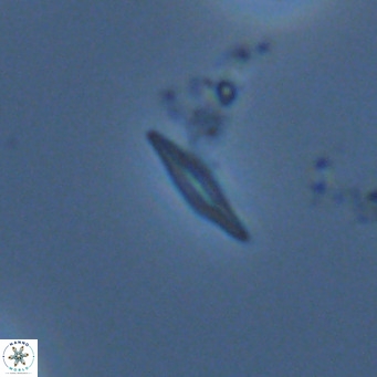 Calciosolenia fossilis VR 04991