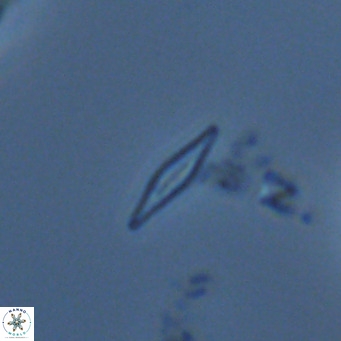 Calciosolenia fossilis VR 04993