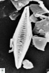 Calciosolenia fossilis 7mic Jason Bay 100 1