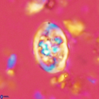 Calcicalathina clipeus 2041