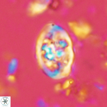 Calcicalathina clipeus 2041