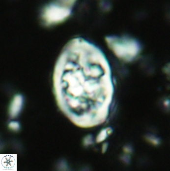 Calcicalathina clipeus 2041
