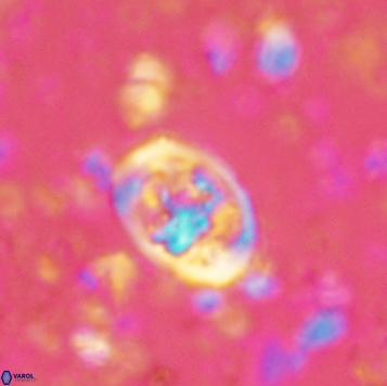 Calcicalathina clipeus 2176