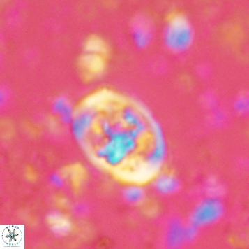 Calcicalathina clipeus 2176