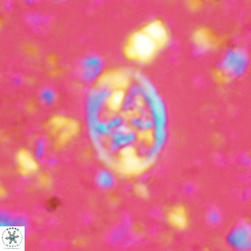 Calcicalathina clipeus 2177