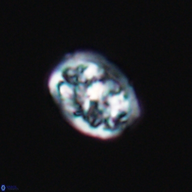 Calcicalathina erbae 11445