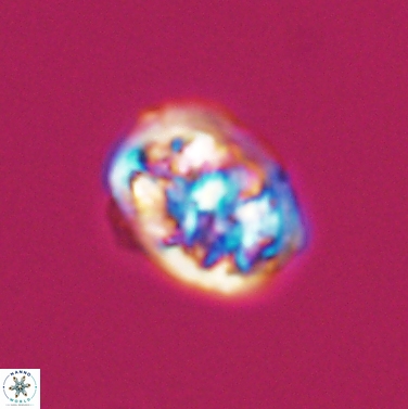Calcicalathina erbae 11446
