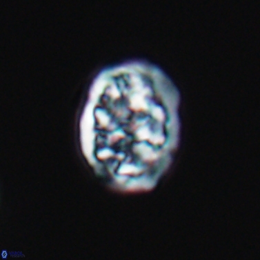 Calcicalathina erbae 11447