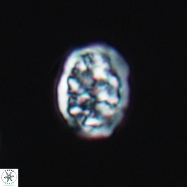 Calcicalathina erbae 11447