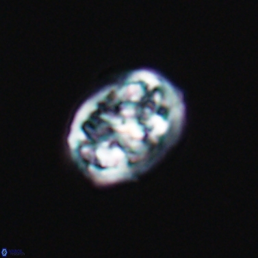 Calcicalathina erbae 11449