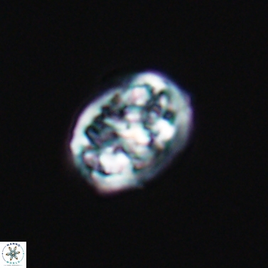 Calcicalathina erbae 11449