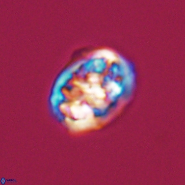 Calcicalathina erbae 11450